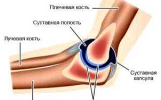 Остеохондроз локтевого сустава