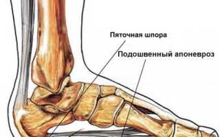 Пяточная шпора рентген