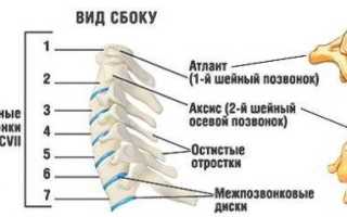 Головокружение при остеохондрозе шейного отдела позвоночника