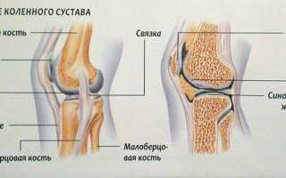 Болит коленка чем лечить