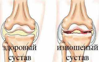 Болит левый локоть